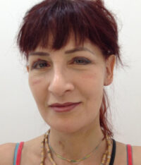 Facelift